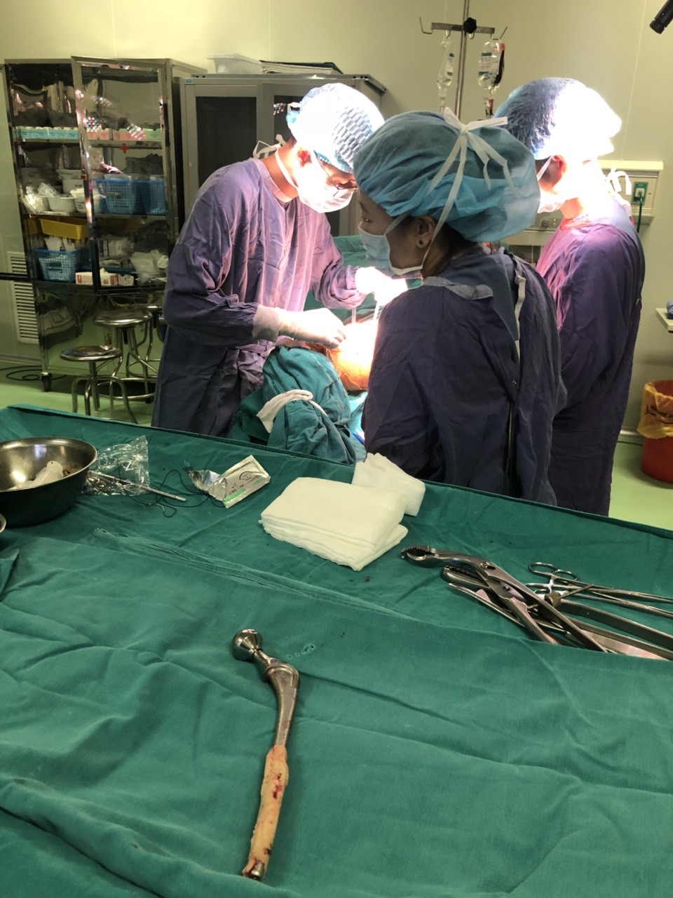 using-the-longest-hip-prosthesis-at-the-present-to-save-a-patient-who